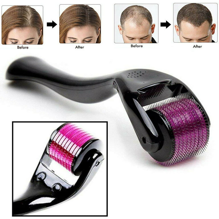 Derma Roller (0.5 size only) Titanium Micro Needles for Beard Growth and Hair Loss 0.5mm Smoothen Skin & Reduce Fine Lines Face roller best - Image 4